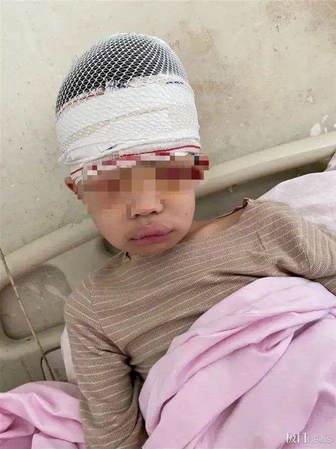 网传河南“男孩被体罚致头皮头骨分离”,警方通报孩子伤情为轻伤且教师被刑拘 网传河南“男孩被体罚致头皮头骨分离”,警方通报孩子伤情为轻伤且教师被刑拘