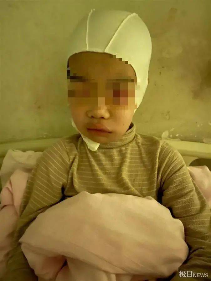 网传河南“男孩被体罚致头皮头骨分离”,警方通报孩子伤情为轻伤且教师被刑拘 网传河南“男孩被体罚致头皮头骨分离”,警方通报孩子伤情为轻伤且教师被刑拘